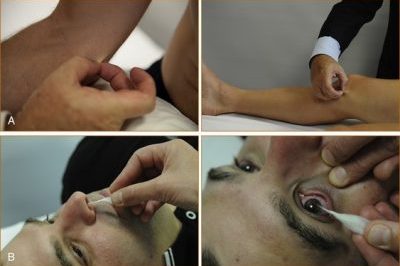 Neuro stimulation testing. Or level of consciousness testing.