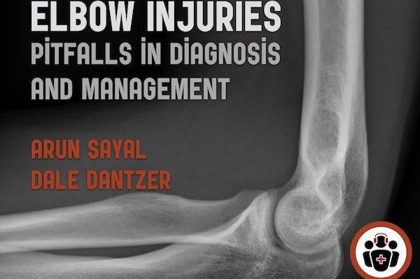 Best orthopaedic teaching page ever! For elbow injuries.