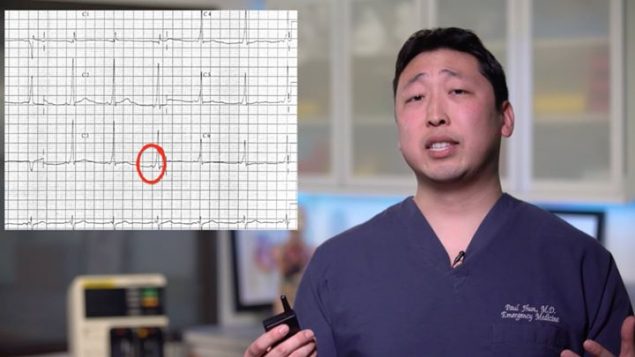 ordering-an-ecg-for-your-patient-with-syncope.jpg Ordering an ECG for your patient with syncope?