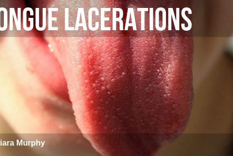 Finally something you can get your teeth into.