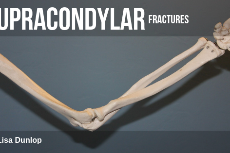 Supracondylar Fractures