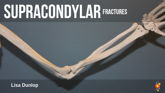 supracondylar-fractures.png Supracondylar Fractures