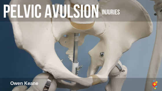 pelvic-avulsion-injuries.png Pelvic avulsion injuries