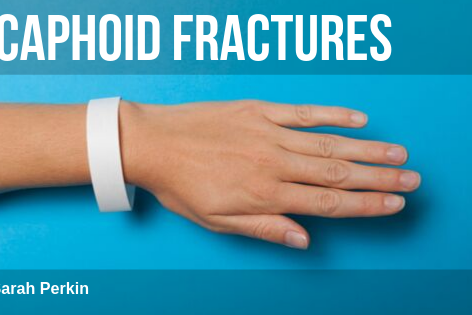 Scaphoid Fractures